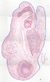 http://www.peac-mrc.mds.qmul.ac.uk/images/histology.png